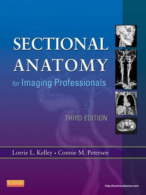 cover image of Sectional Anatomy for Imaging Professionals--E-Book